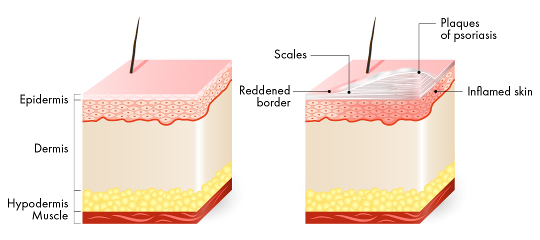 e-category-page-1080x648-bioptron-(1)-copy.jpg e-category-page-1080x648-bioptron-(1)-copy.jpg