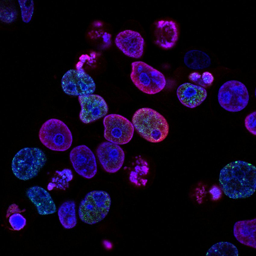 In-vitro-Studie zeigt starke zytotoxische und antiproliferative Effekte von 3HFWC in Kombination mit Bioptron® hyperpolarisiertem Licht auf humane Melanomzellen